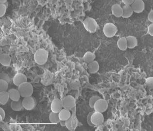 Cryo-SEM image of an S. aureus biofilm grown on catheters
