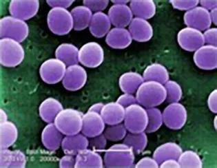  S. aureus biofilms stained with Z and B-DNA antibodies and imaged using a confocal microscope