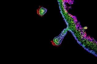 Image of a human skin organoid derived entirely from pluripotent cells