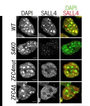SALL4 binding to AT-rich heterochromatin depends on zinc finger cluster 4 (ZFC4)