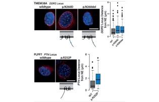 Illustration of Eric Schirmer's research, details in text