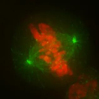 Electron microscope cell image in green and red