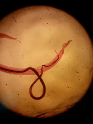 A pair of schistosoma mansoni parasites (Alaa/Wikimedia Commons )