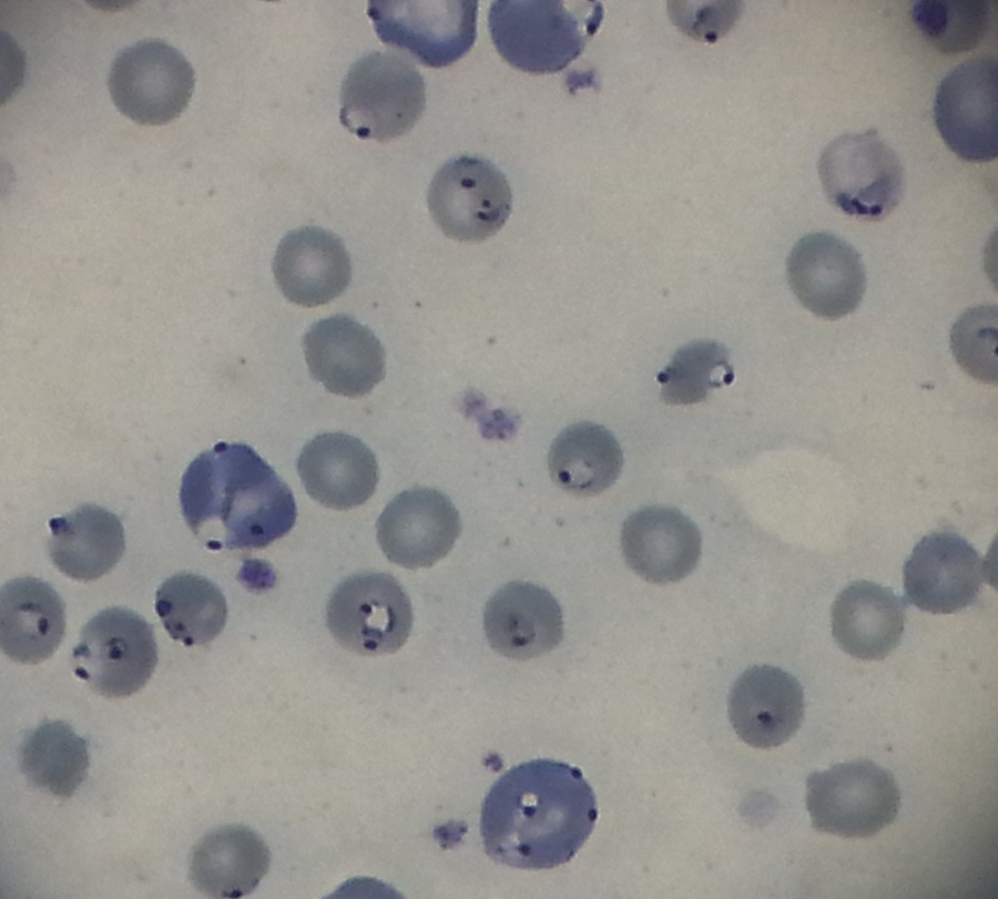 Plasmodium chabaudi inside red blood cells