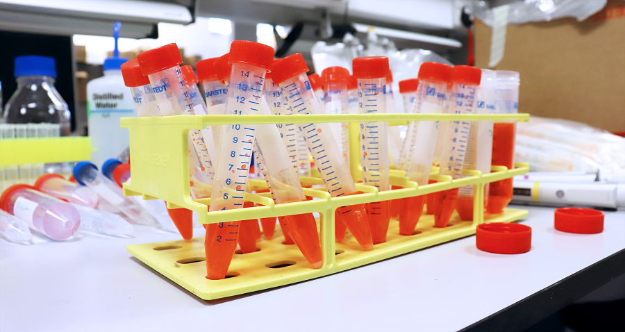 Adipic acid bacteria samples - Image Credit: The Wallace Lab