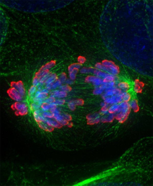 Image from Earnshaw paper, Cancer research 2018