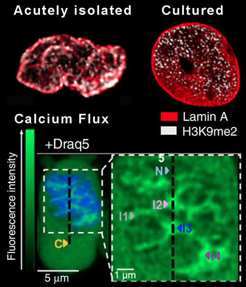 Image from Schirmer paper Nature Communications 2019