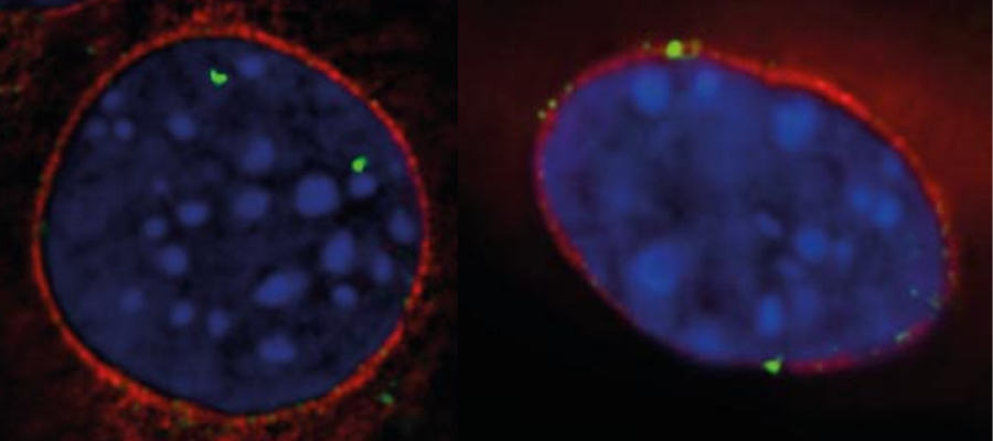 Wild-type and an EDMD disease mutant version of PLPP7 expressed in muscle cells 