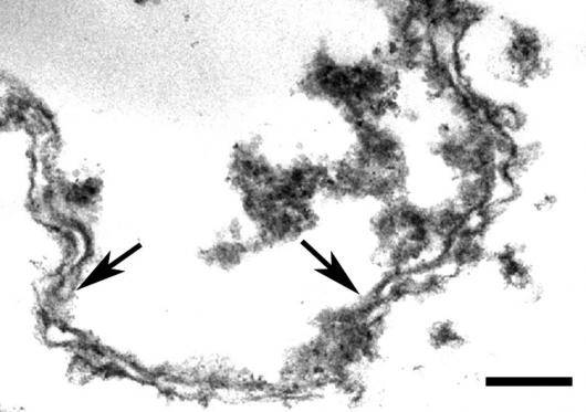 Image from Schirmer paper, Mol Cell Protromics 2010