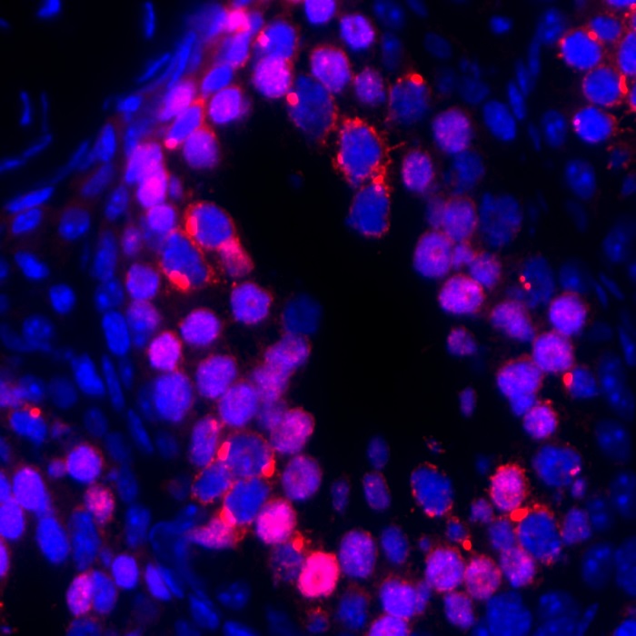 Machinery of the jumping gene LINE1 (red) mounting an attack on the DNA (blue) of germ cells