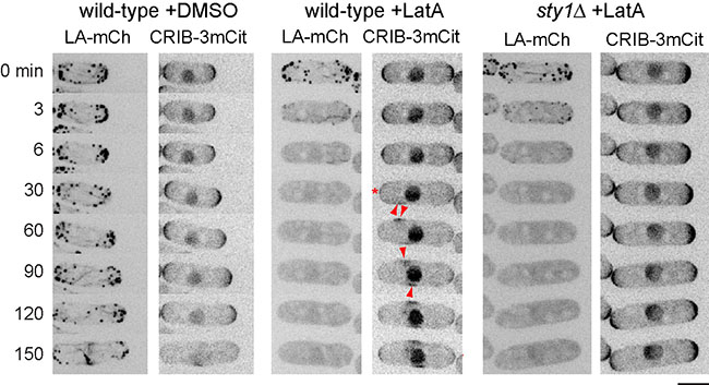 Image from Sawin paper current Biology 2016