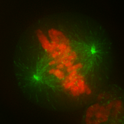 Microtubule about Electron microscope cell image in green and red