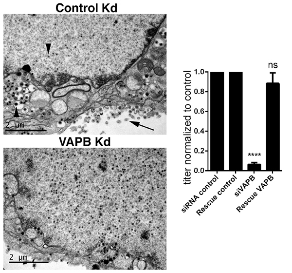 Image from Schirmer paper, Cells 2019