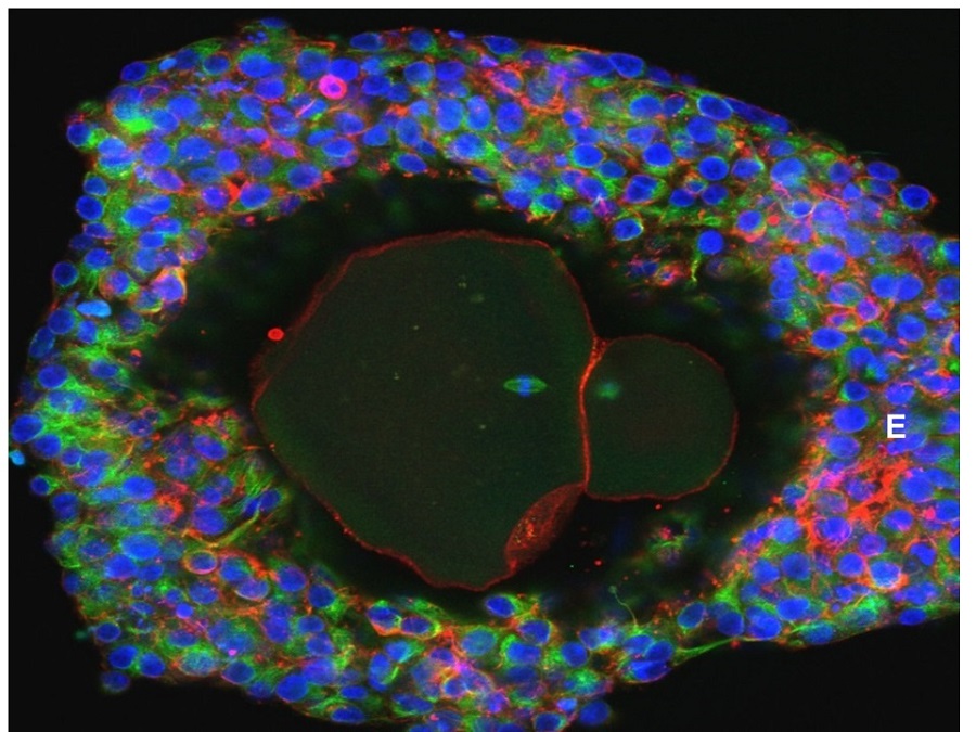 Lab grown human egg