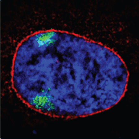 Image from Schirmer paper, Genome Biology 2013